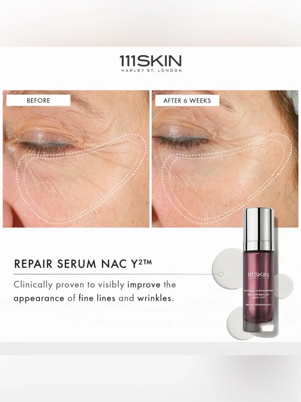 111 Skin Repair Serum NAC Y2, 1 oz.
